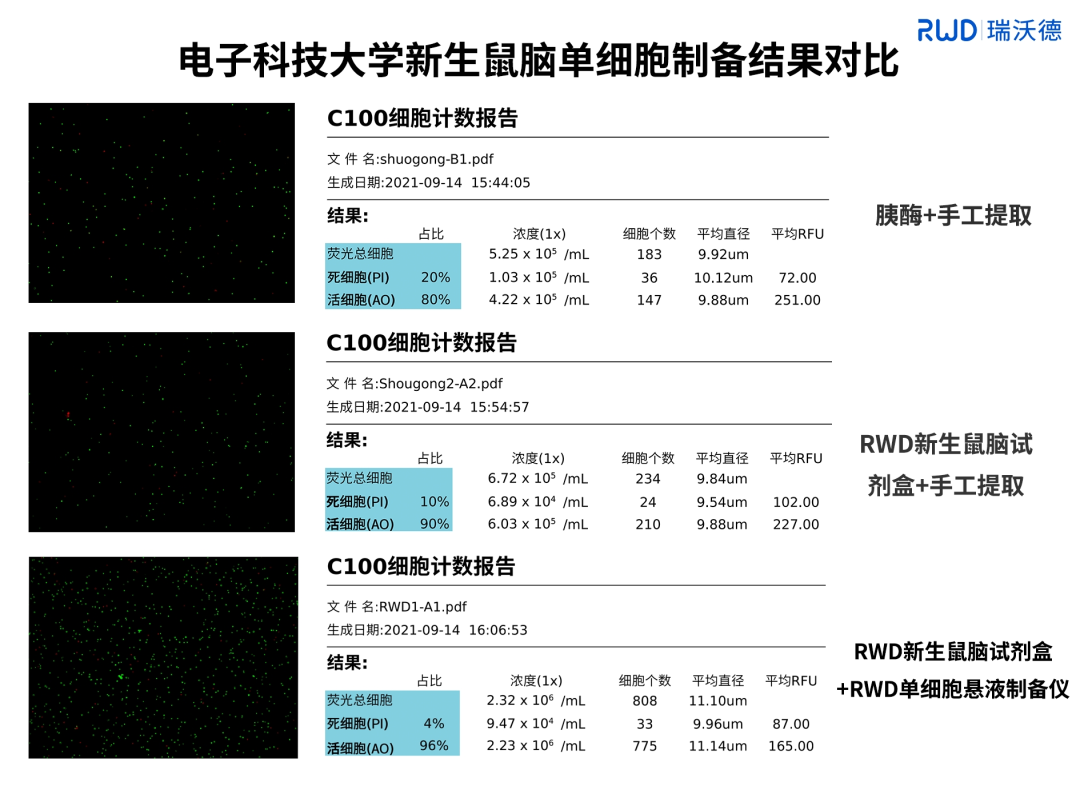 4-電子科技大學(xué)新生鼠腦單細(xì)胞制備結(jié)果對比.png