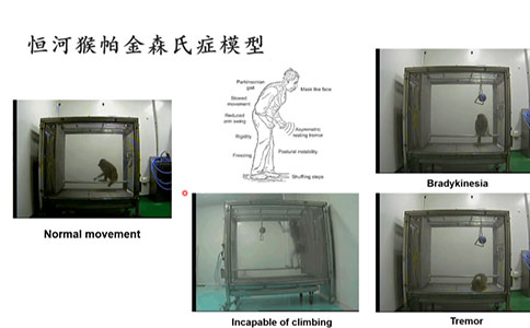 腦血管疾病動物模型領域有哪些創新技術？