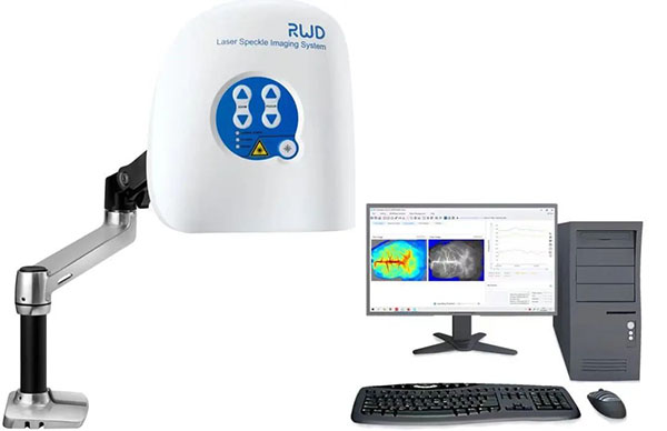 瑞沃德激光散斑血流成像系統
