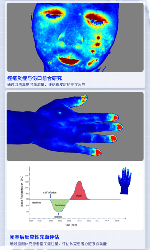 瑞沃德激光散斑血流成像系統獲批FDA認證