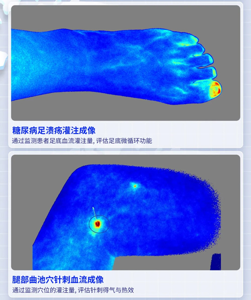 瑞沃德激光散斑血流成像系統獲批FDA認證